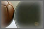 MOLDES MEDICINALES